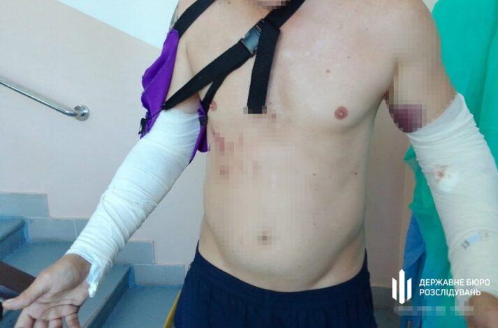ДБР повідомило про підозру інструктору, який побив курсанта на навчальному полігоні