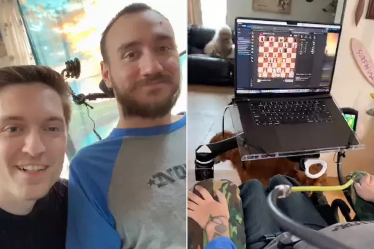 "Я знову відчуваю себе повноцінною людиною": історія першого пацієнта з нейрочипом у мозку (відео)